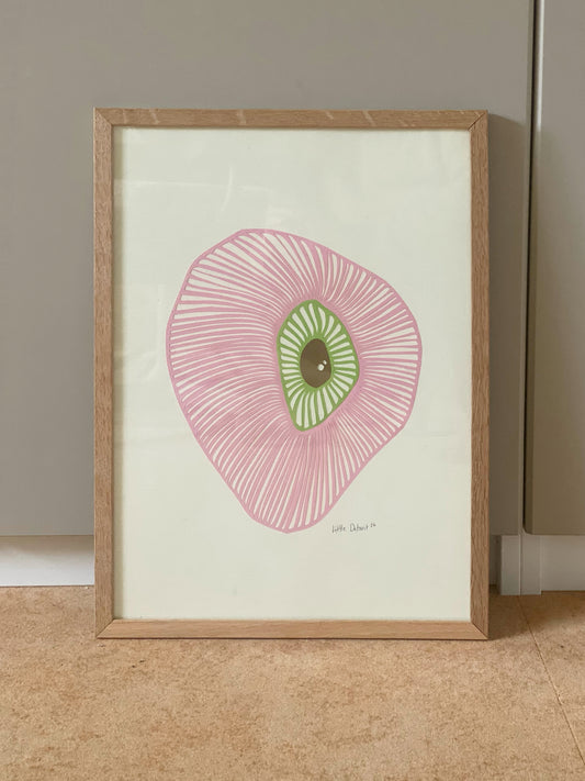 "Strawberry eye" A3